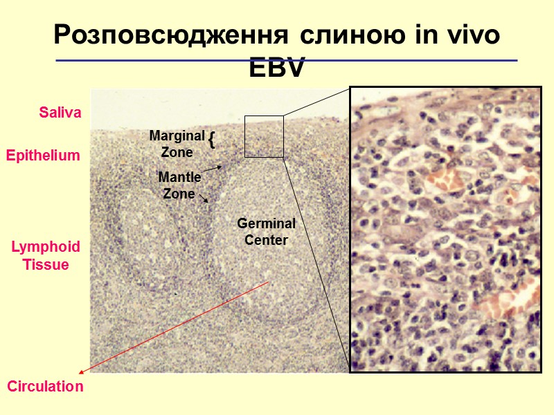 Germinal Center Mantle Zone Розповсюдження слиною іn vivo EBV Marginal Zone { Epithelium Lymphoid